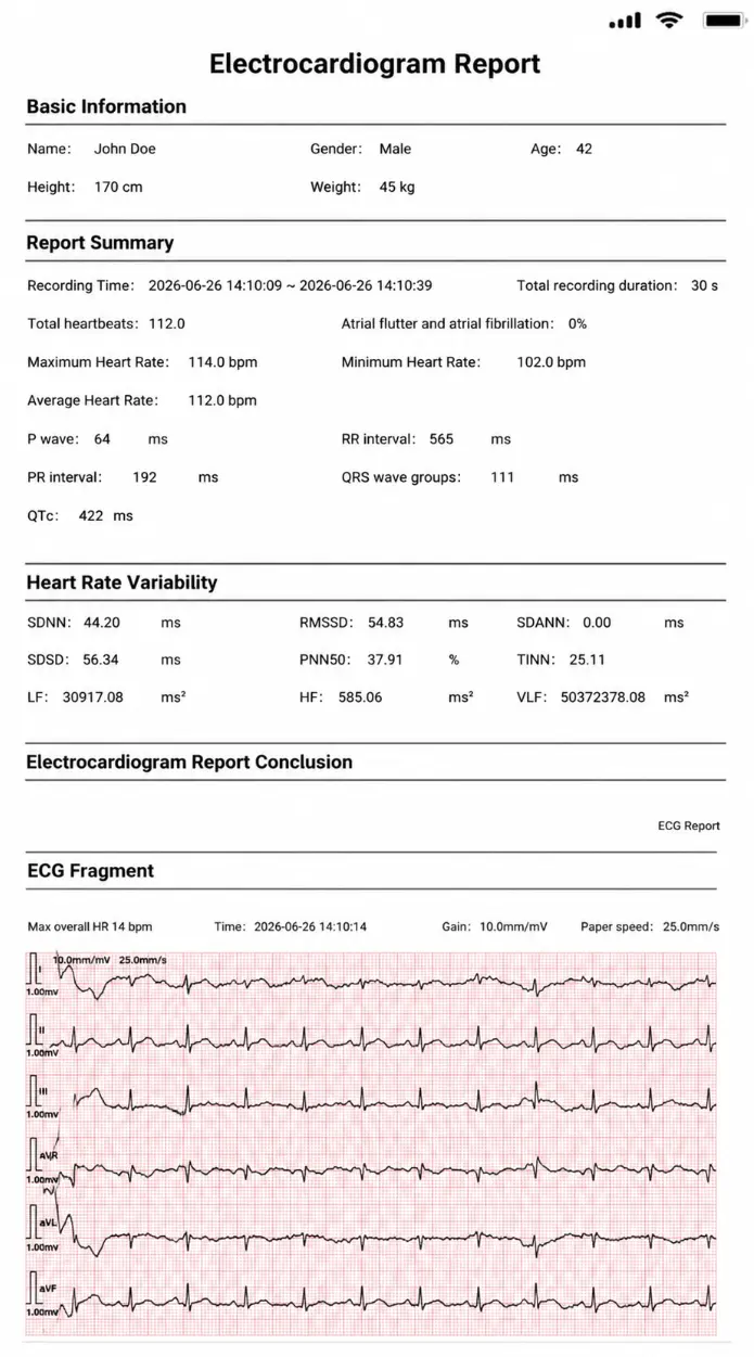 Detailed ECG Reports
