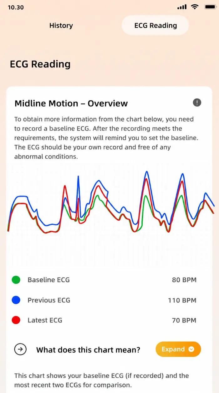 Quick ECG Recording